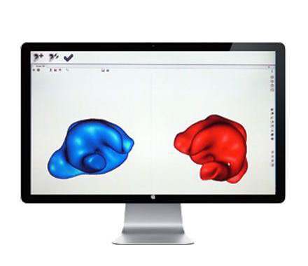 Conception de vos protecteurs auditifs sur mesure - Exemple d'empreintes scannées en 3D, en bleu la gauche et en rouge la droite Scan 3D des empreintes d'oreilles afin de concevoir vos protections auditives sur mesure
